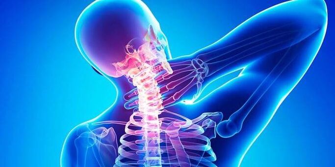 Osteohondroza materničnega vratu