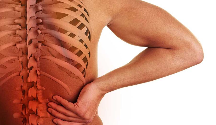 Osteohondroza ledvene hrbtenice