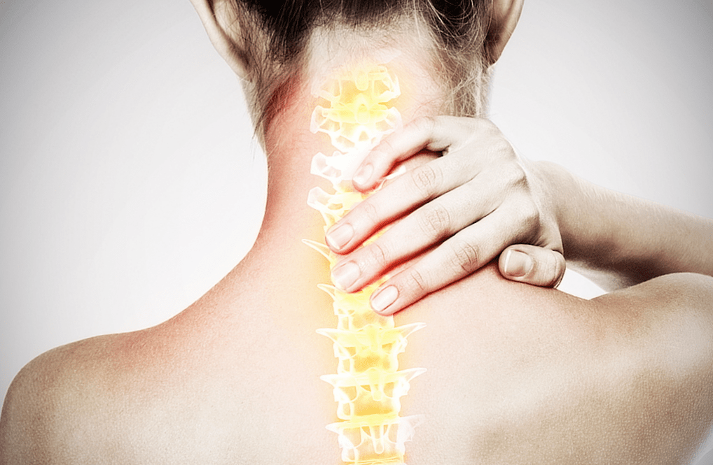 osteohondroza vratne hrbtenice